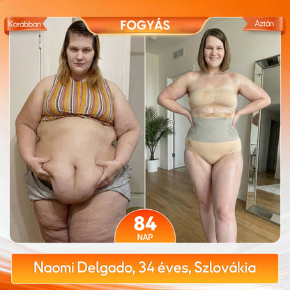 🍃🍃A márka hivatalos üzlete | 🧑‍⚕️GFOUK® 2026 Moringa és berberin 4 az 1-ben mikrorészecskés alakformáló és zsírégető rövidnadrág