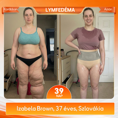 🍃🍃A márka hivatalos üzlete | 🧑‍⚕️GFOUK® 2026 Moringa és berberin 4 az 1-ben mikrorészecskés alakformáló és zsírégető rövidnadrág